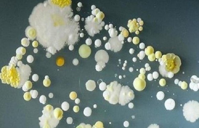 Dokazano da je telefon leglo bakterija