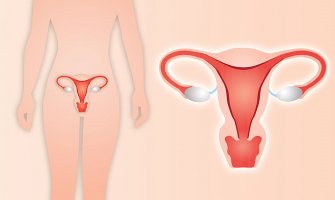 Kada je vađenje materice jedino rješenje: Šta uraditi nakon zahvata?