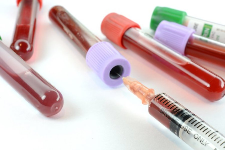 syringehivaids