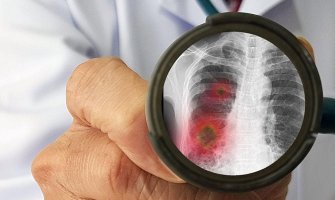 Kina prijavila još 17 slučajeva zaraze koronavirusom, Južna Koreja 35