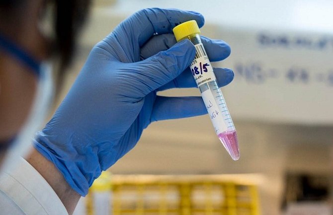 Veliki broj novooboljelih u Srbiji u posljednja 24 sata, jedna osoba preminula