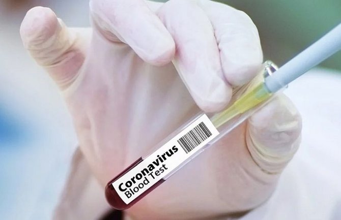 U Indiji za 12 dana potvrđeno pola miliona slučajeva koronavirusa