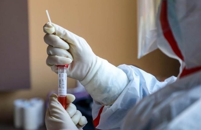 Republika Srpska: U posljednja 24 časa još 14 pozitivnih na koronavirus