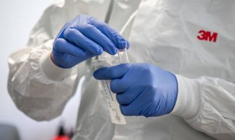 U Hrvatskoj preminulo 65 pacijenata, potvrđena još 1.472 slučaja zaraze koronavirusom
