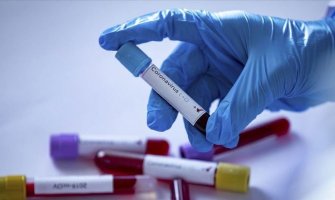 Na Kosovu preminulo 19 osoba, još 711 pozitivnih