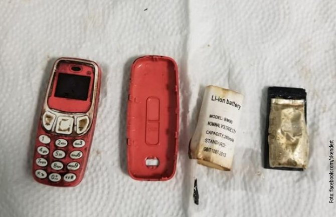 Kosovo: Muškarac progutao telefon,ljekari ga izvadili bez klasične operacije(FOTO)